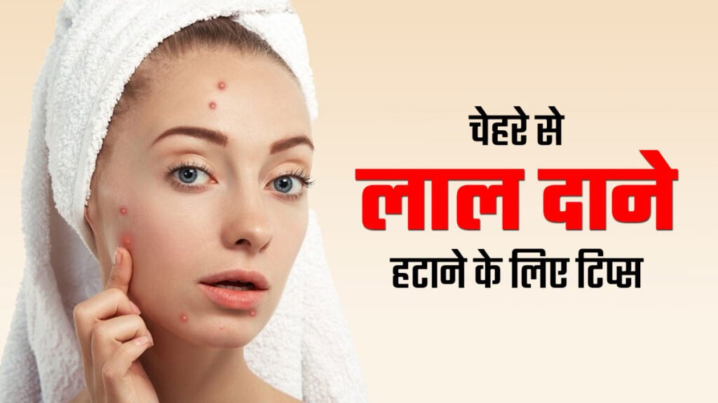 साफ और ग्लोइंग स्किन के लिए आसान उपाय | Home Remedies For Pimples On Face